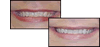 before and after