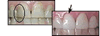 before and after
