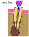 hand file
